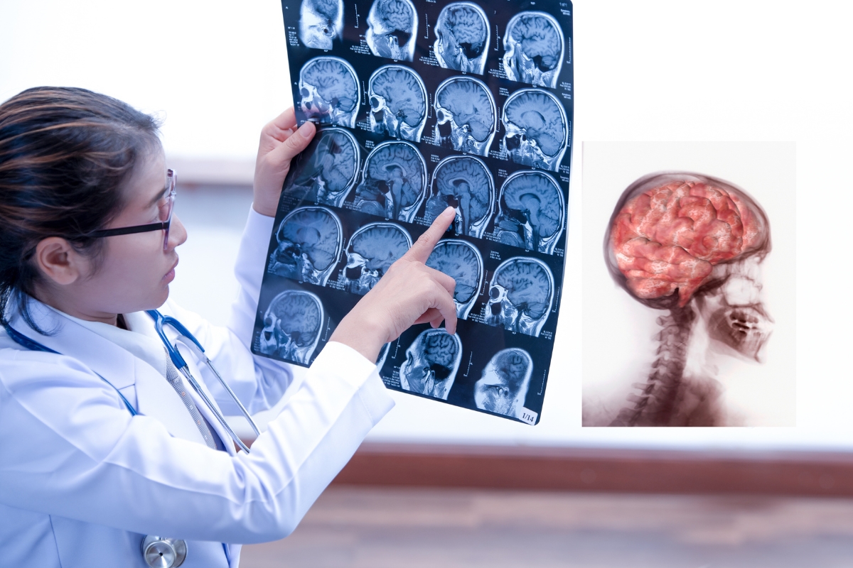 Springfield Brain Injury Victims Lawyers - Rah Law