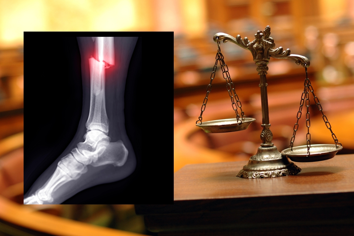 Broken Bones & Scarring Lawyers in Missouri MO at Rah Law